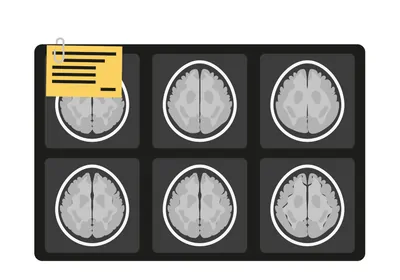 illustration of multiple brain scan images